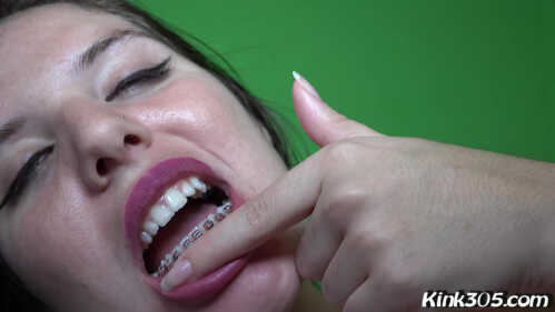 Kink305 Lola Star 展示我的牙箍